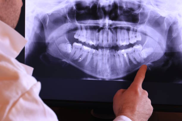 Best Broken or Chipped Tooth Repair in Whispering Pines, NC