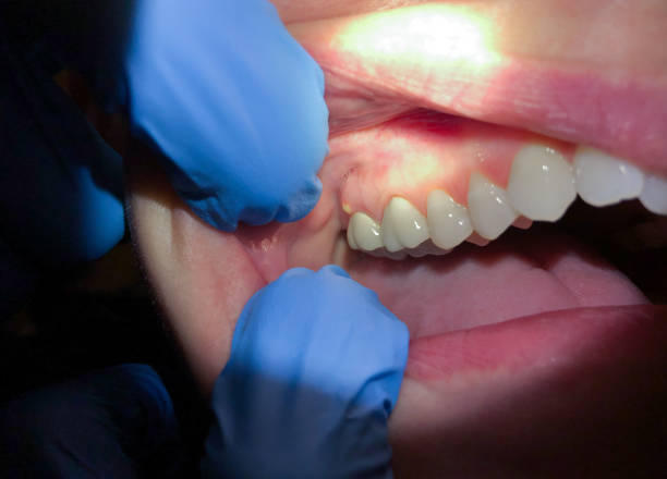 Best Emergency Care for Gum Disease in Whispering Pines, NC